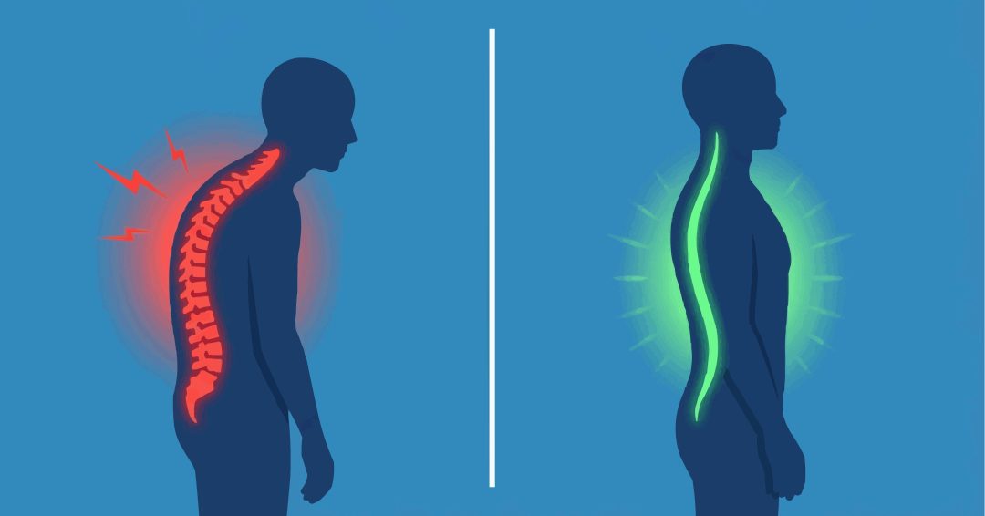 Ergonomic posture comparison vector illustration showing slouched red spine versus straight green spine.